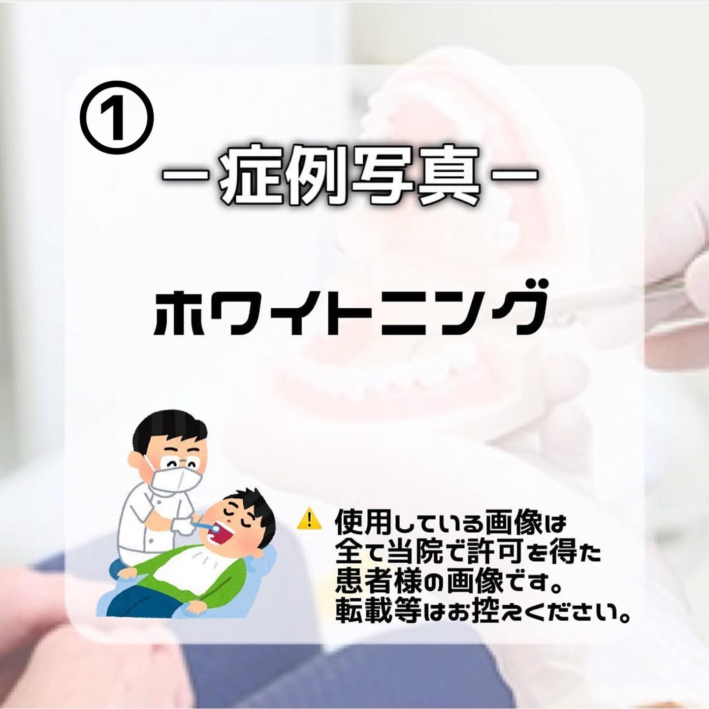 症例写真のご紹介です🦷