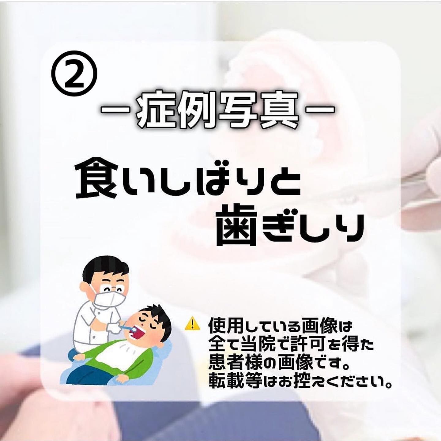 症例写真のご紹介です🦷
