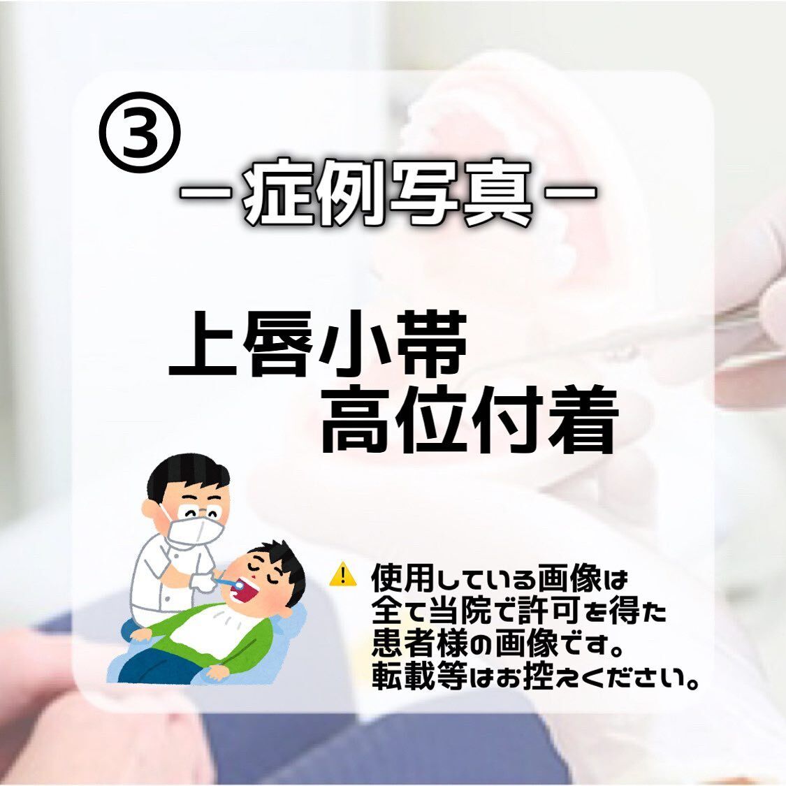 症例写真のご紹介です🦷✨
