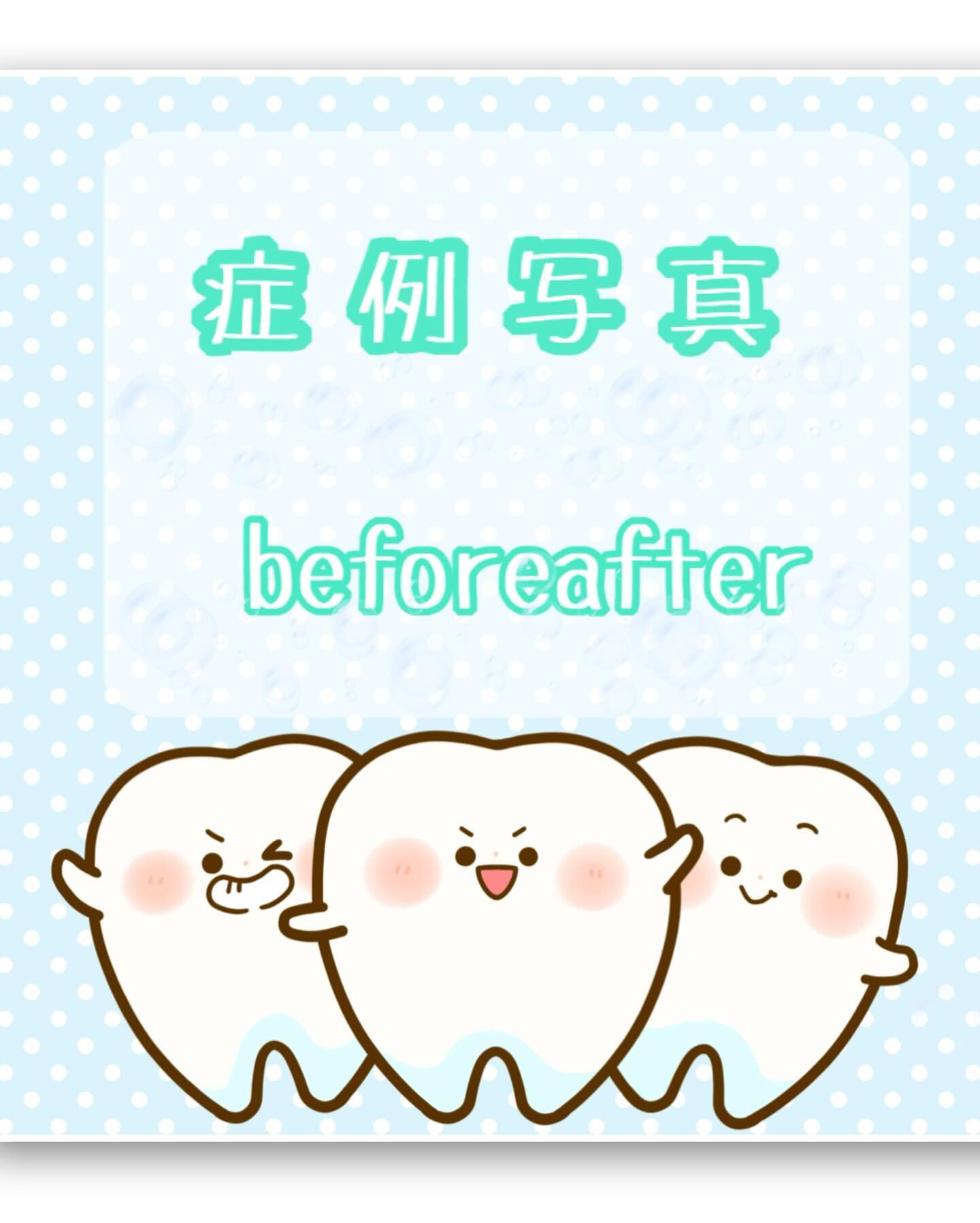 🦷主訴🦷