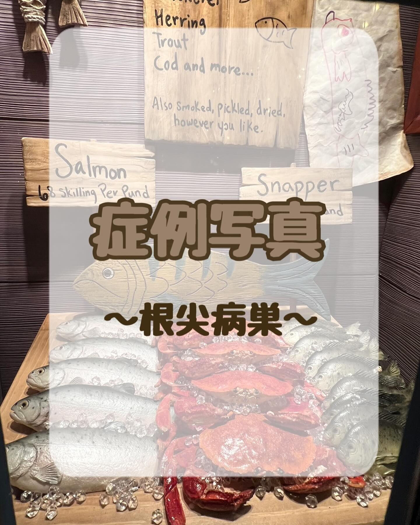 症例写真〜根尖病巣〜