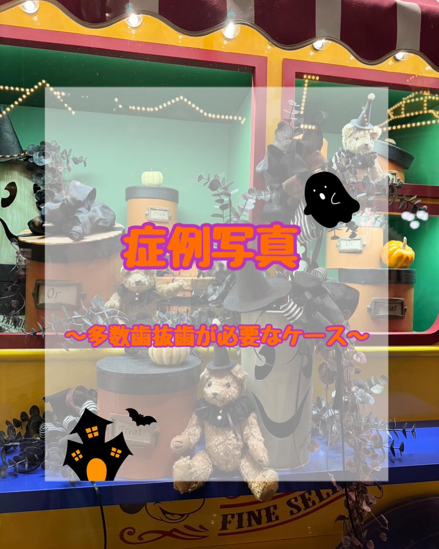 症例写真〜多数歯抜歯が必要なケース〜