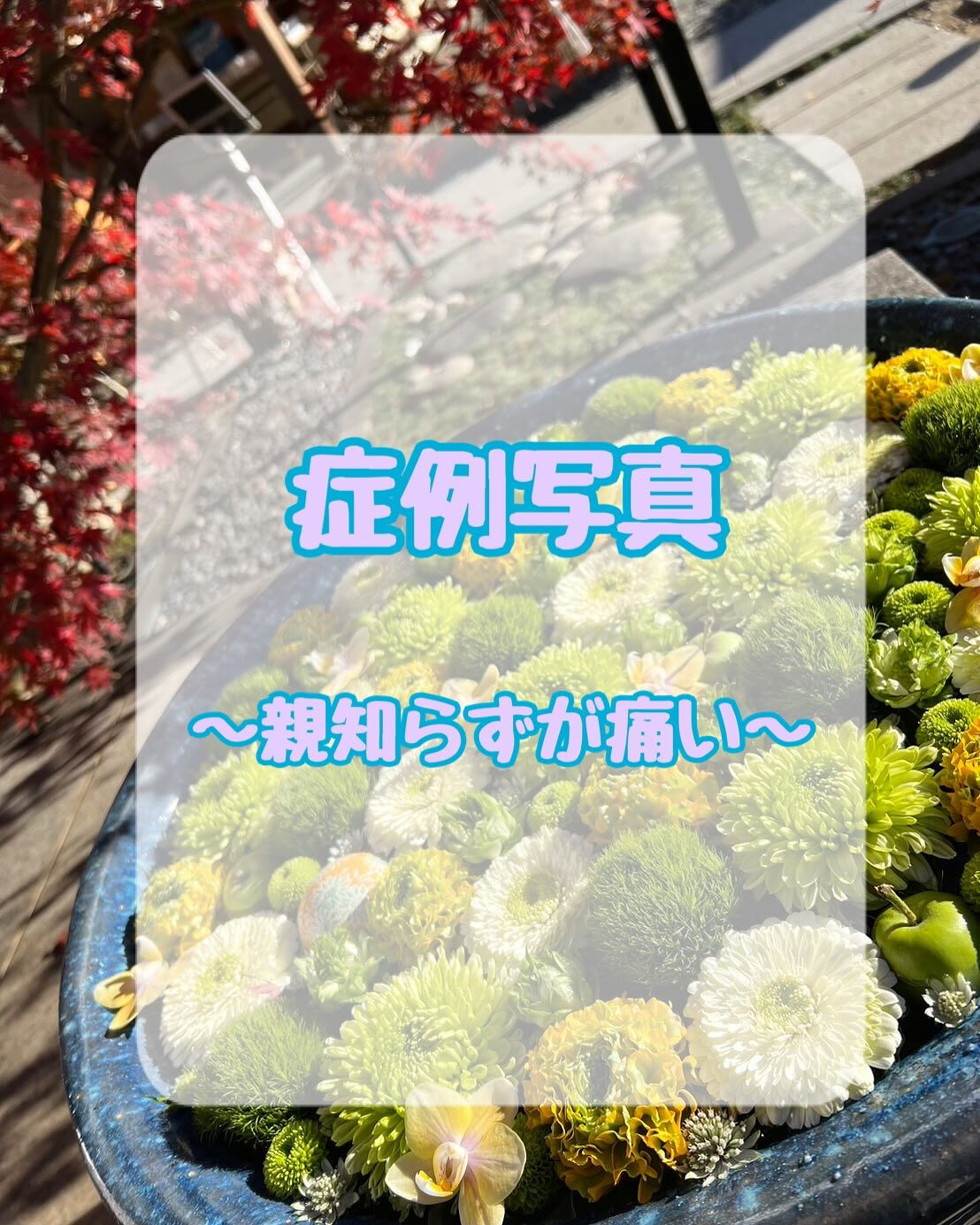 症例写真〜親知らずが痛い！〜