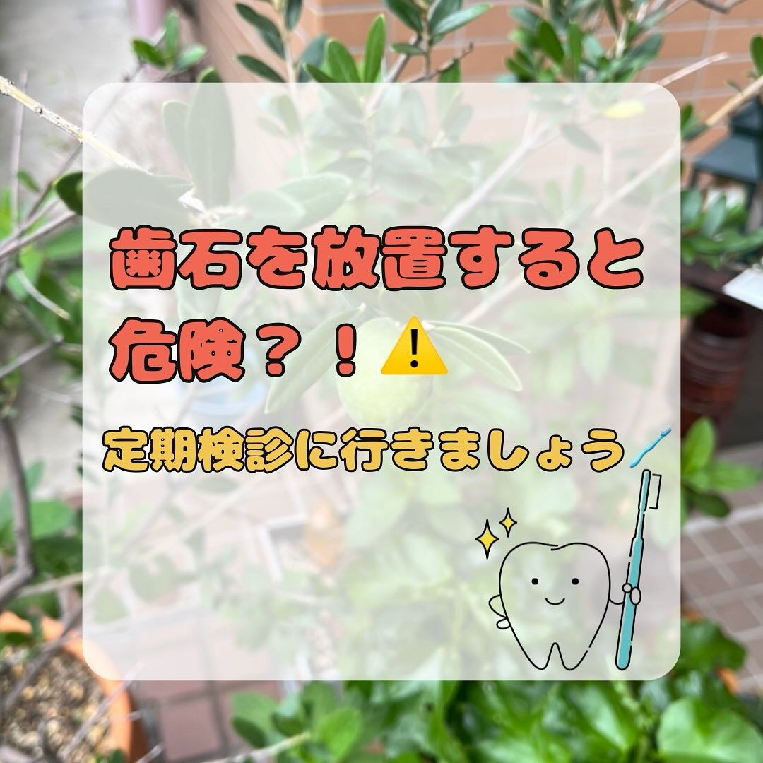 今日は歯石のお話です🔥