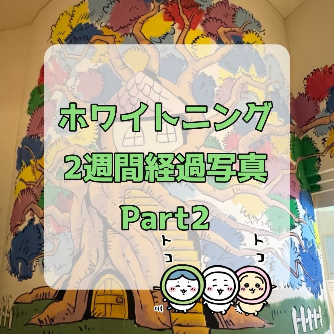以前投稿したホームホワイトニング2週間経過写真の続きです📸