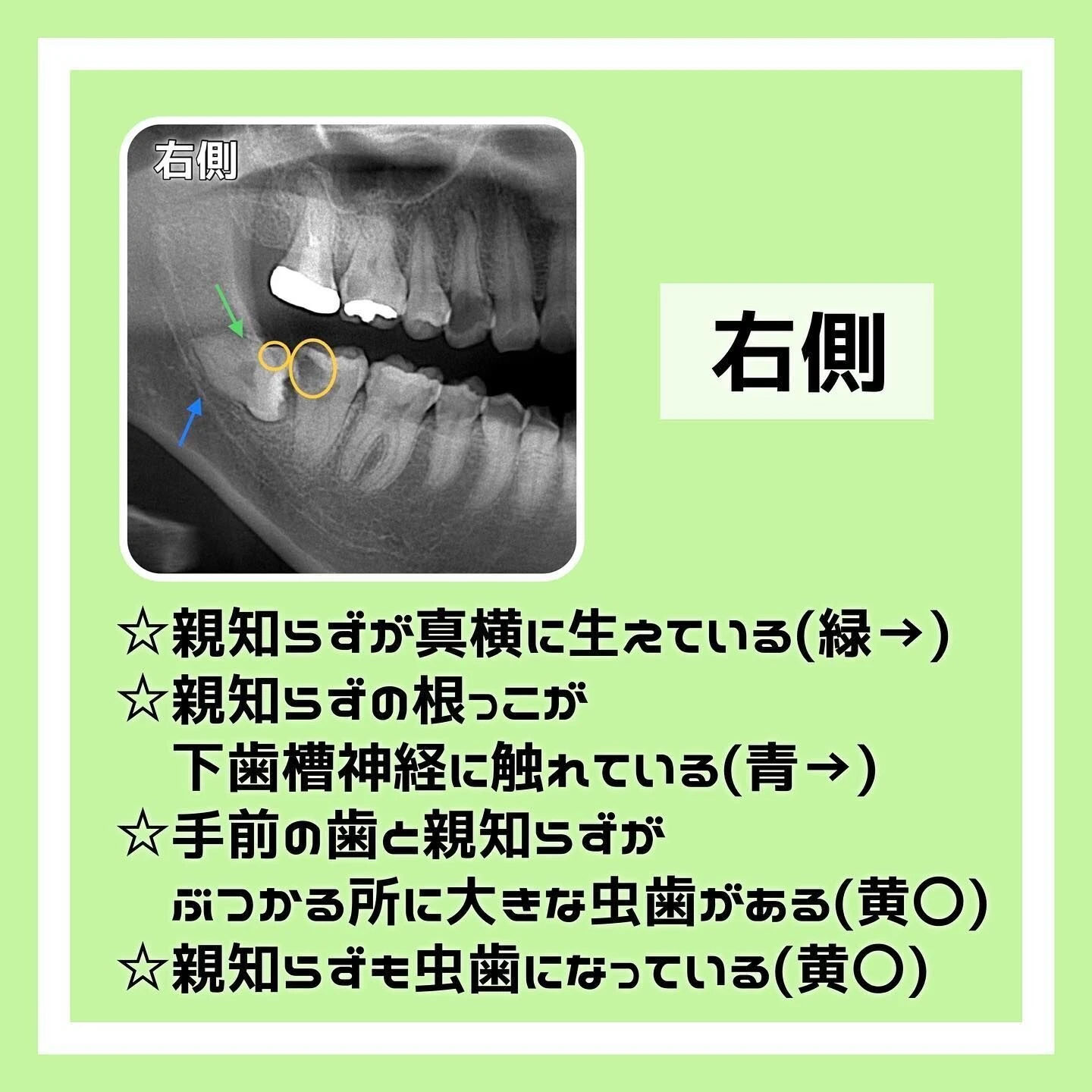 20230614121209_0_2.jpg