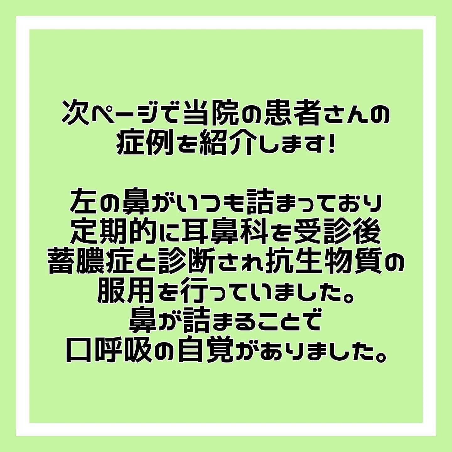 「歯性上顎洞炎」について🦷