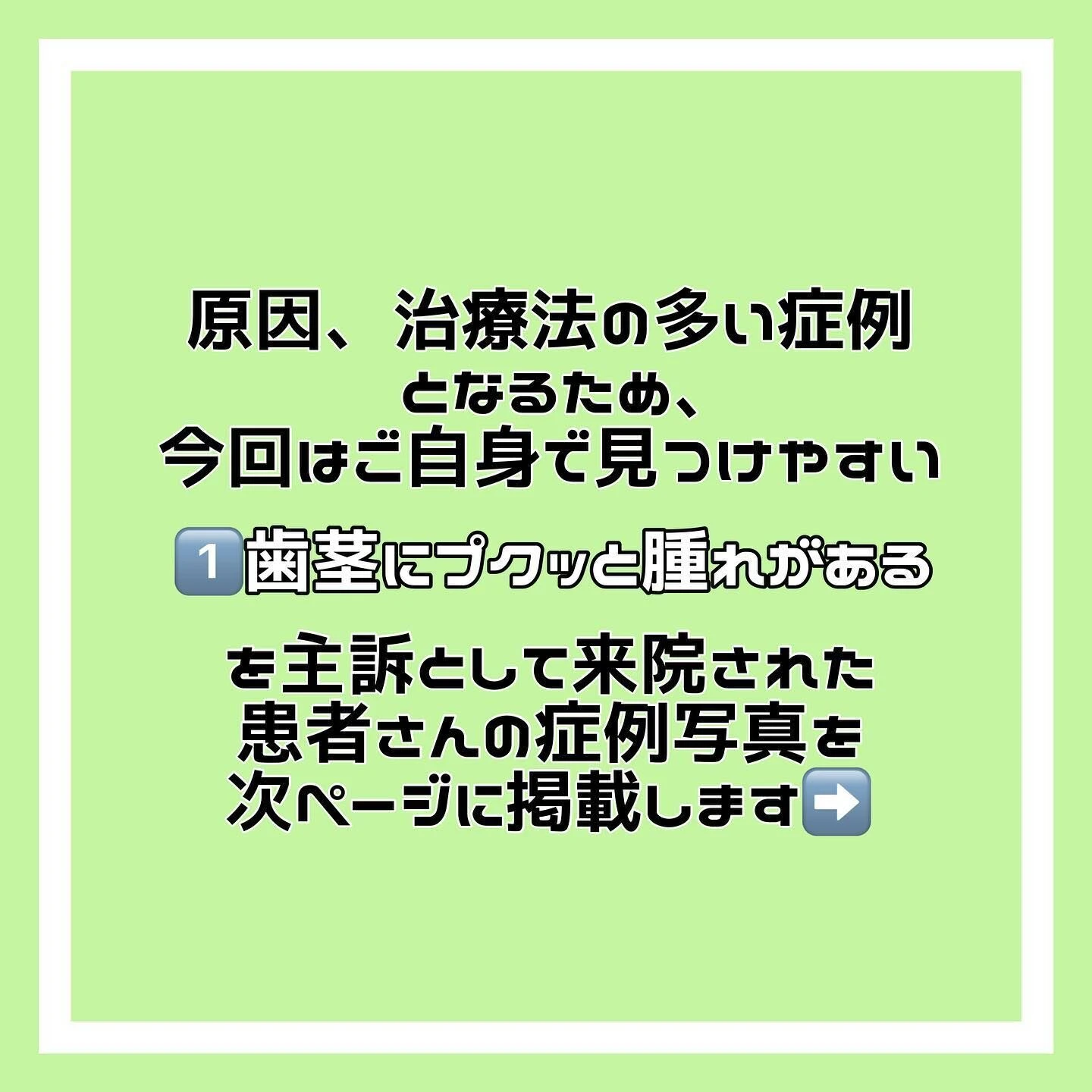 「根尖性歯周炎」について🦷