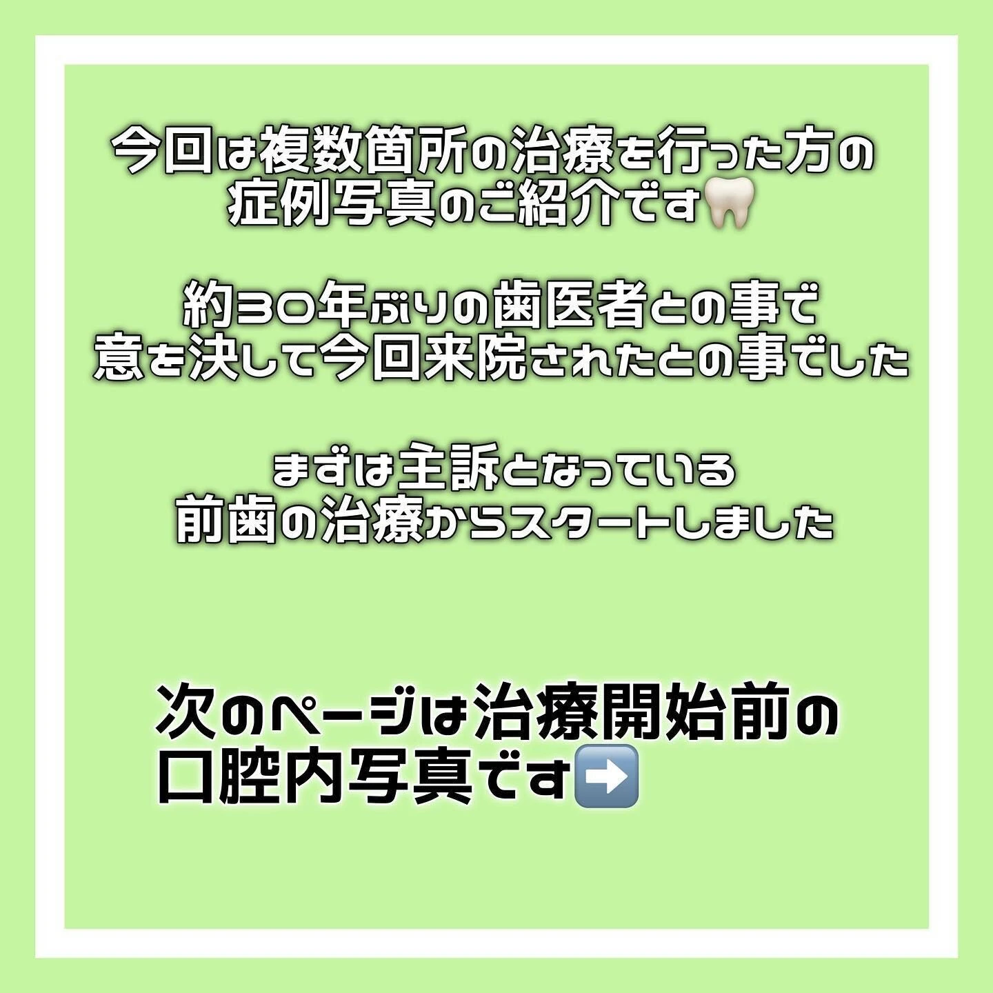 症例写真(Before/After)🦷