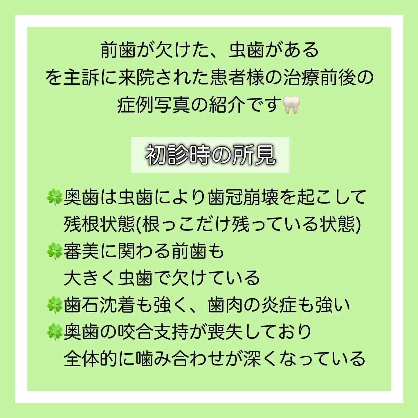 症例写真(Before/After)②🦷