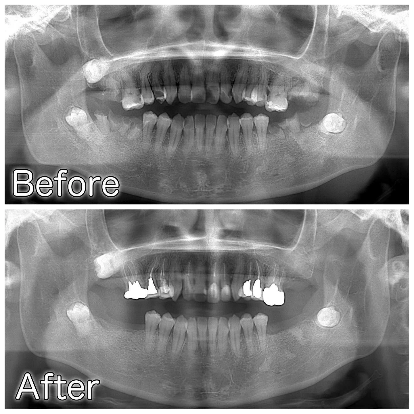 症例写真(Before/After)②🦷