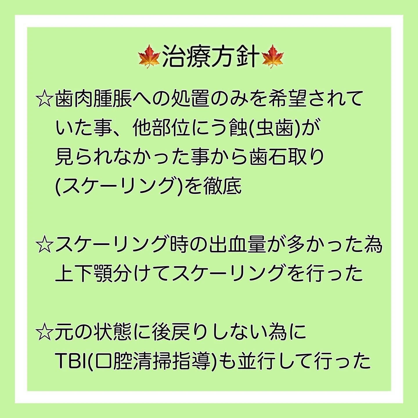 症例写真(Before/After)③🦷