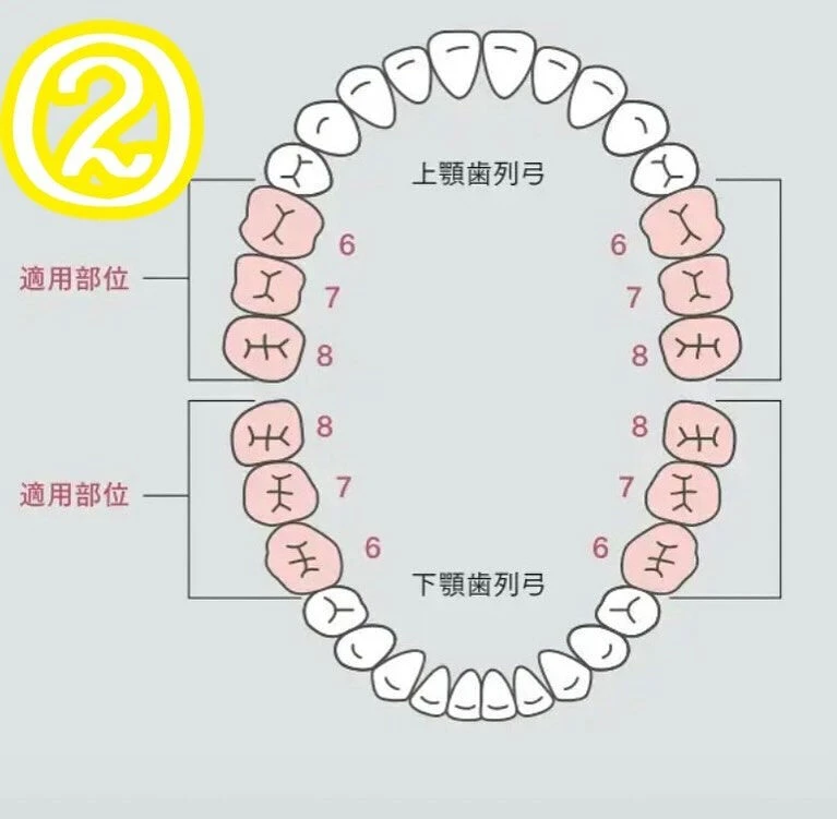 保険で全ての歯が白く出来るようになりました！Part1