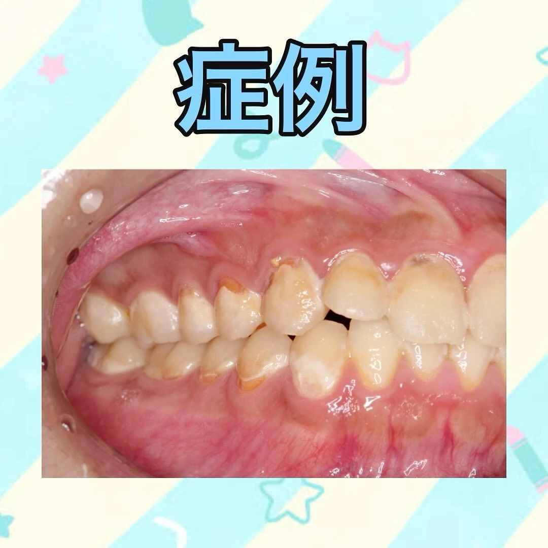前回、Q＆A方式で投稿したスポーツドリンクについての投稿の続...