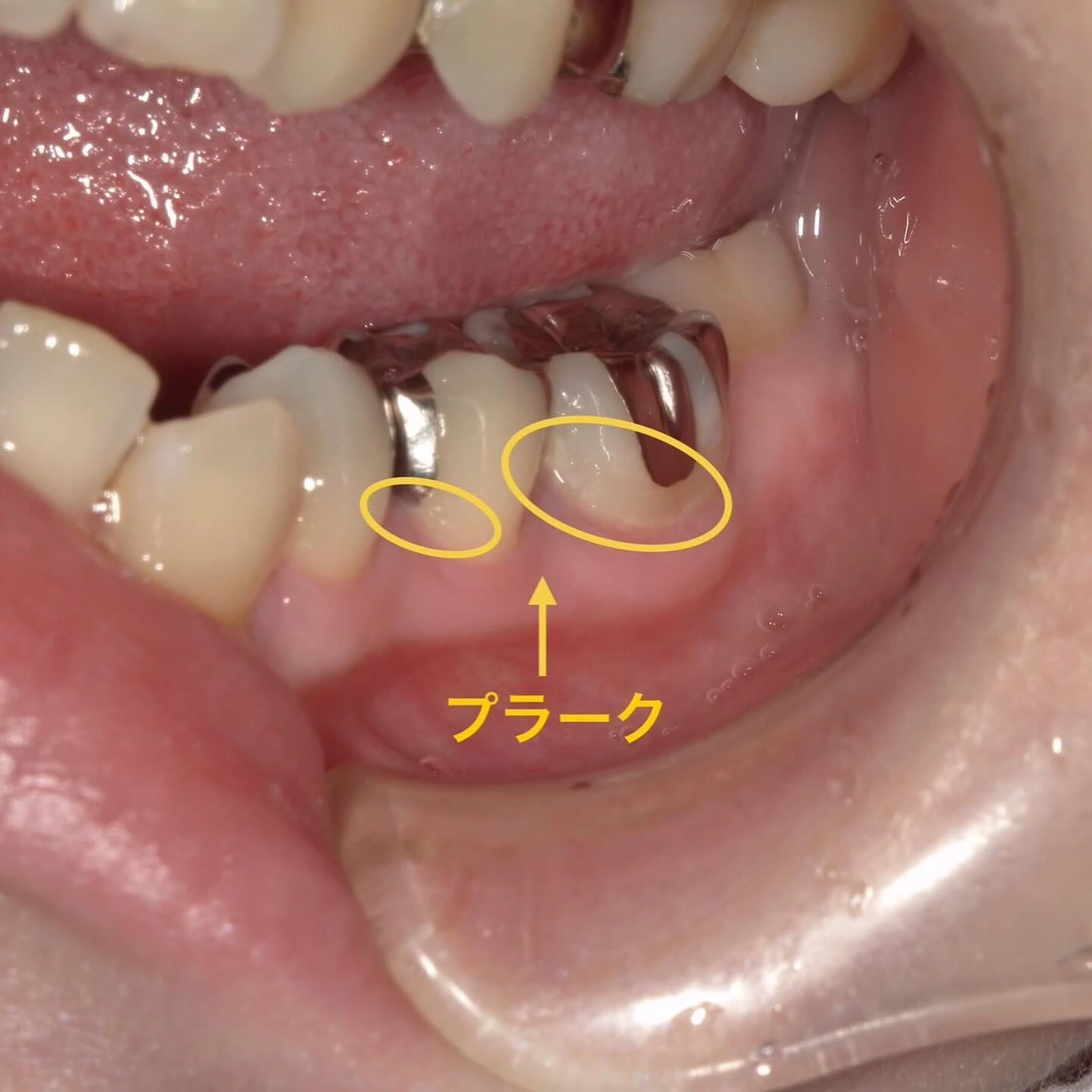 当院は基本的に保険診療を行っております☝️