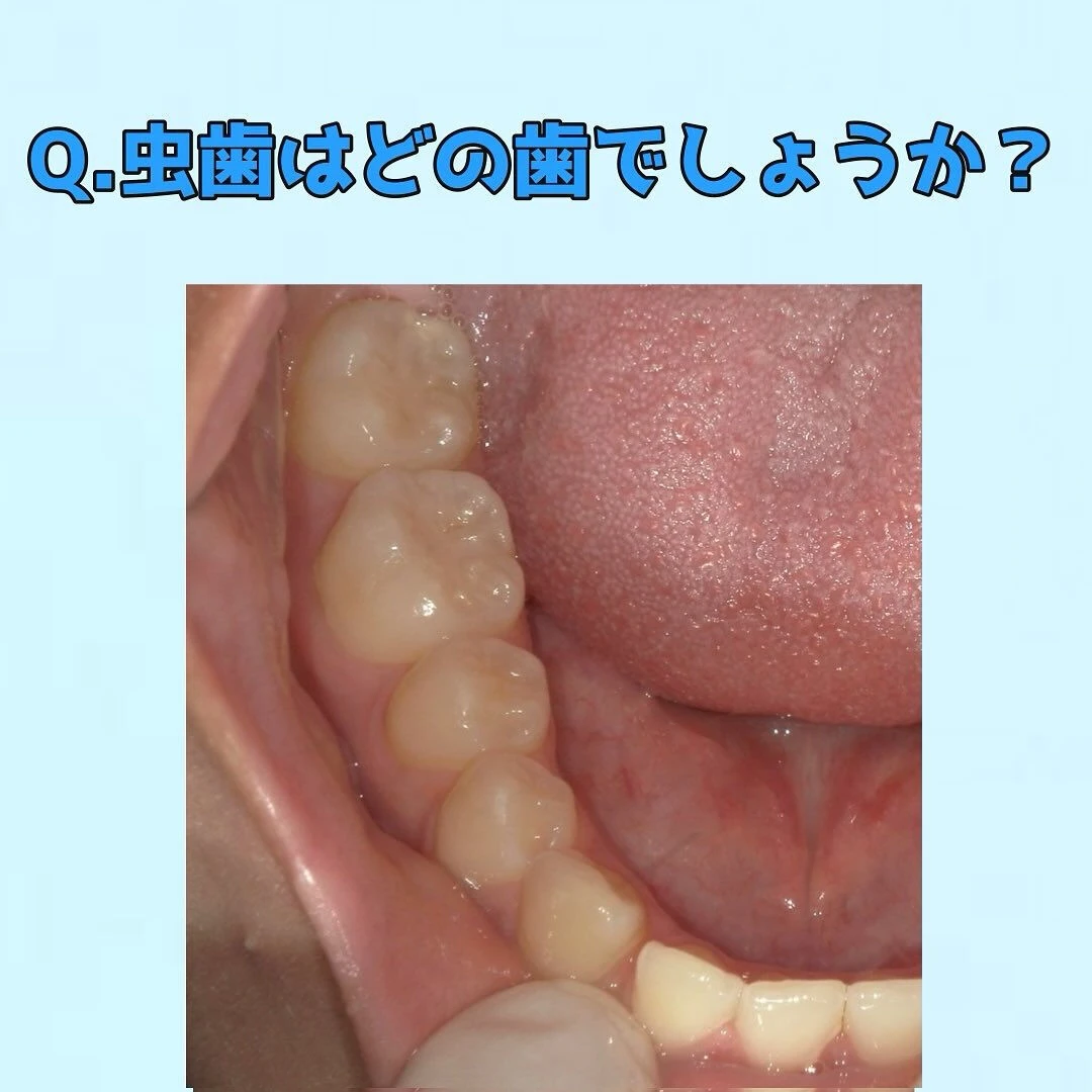 皆さんに質問です👀