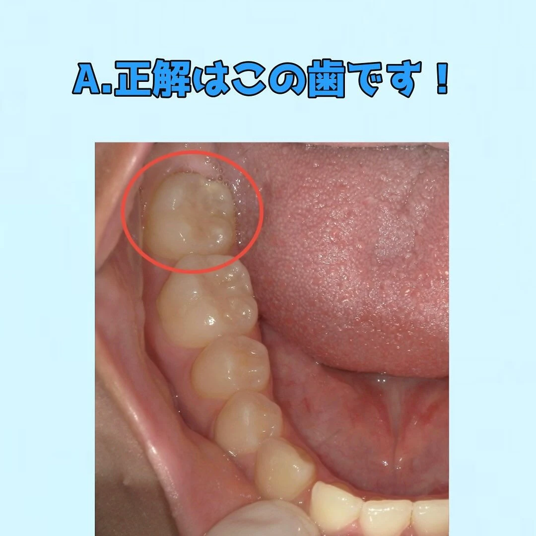 皆さんに質問です👀