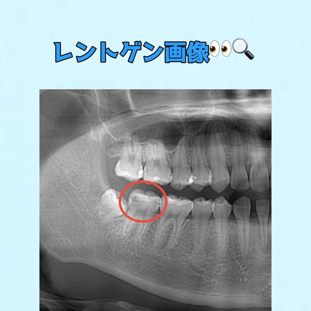 皆さんに質問です👀