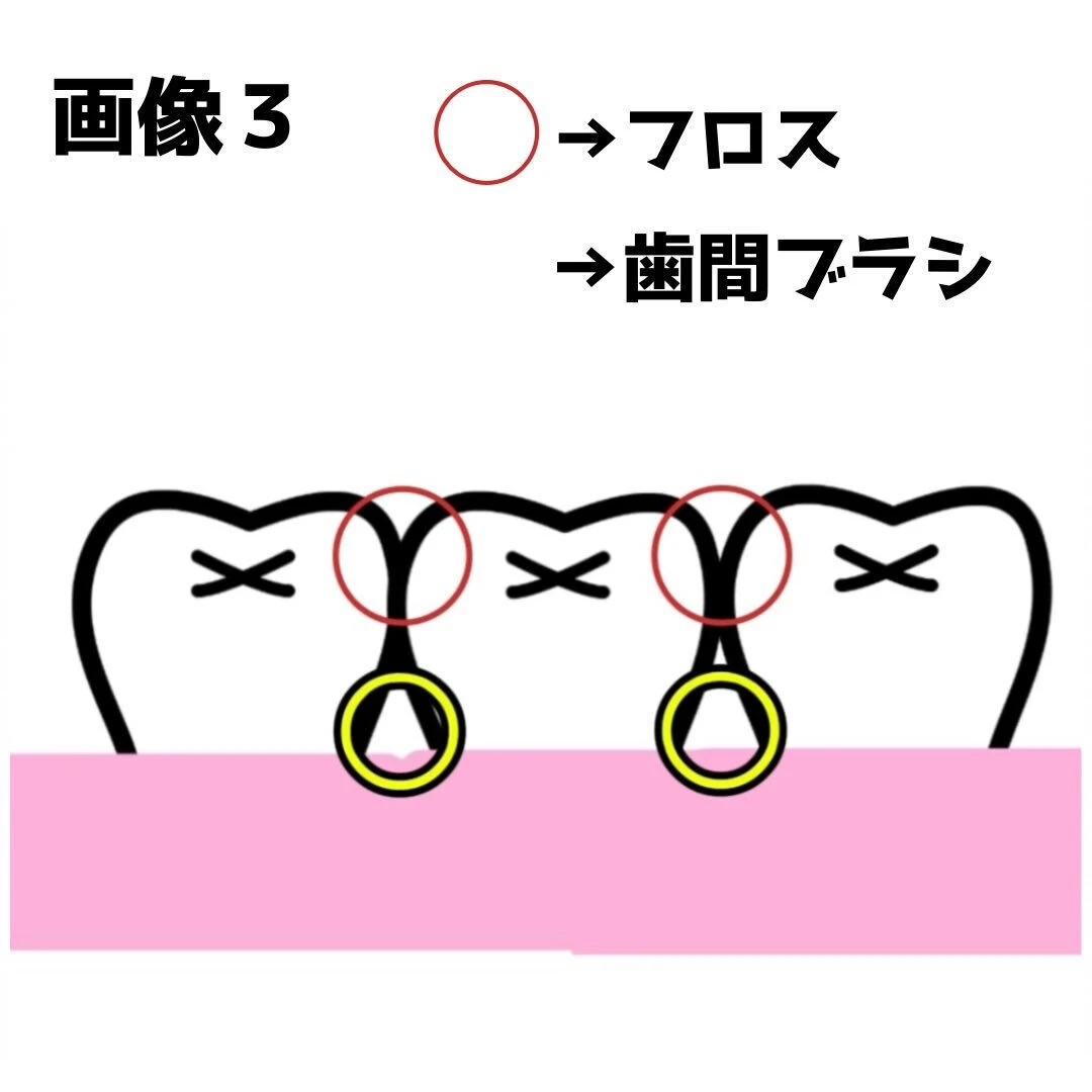 今回はフロス・歯間ブラシの使い方について説明します🙋‍♀️