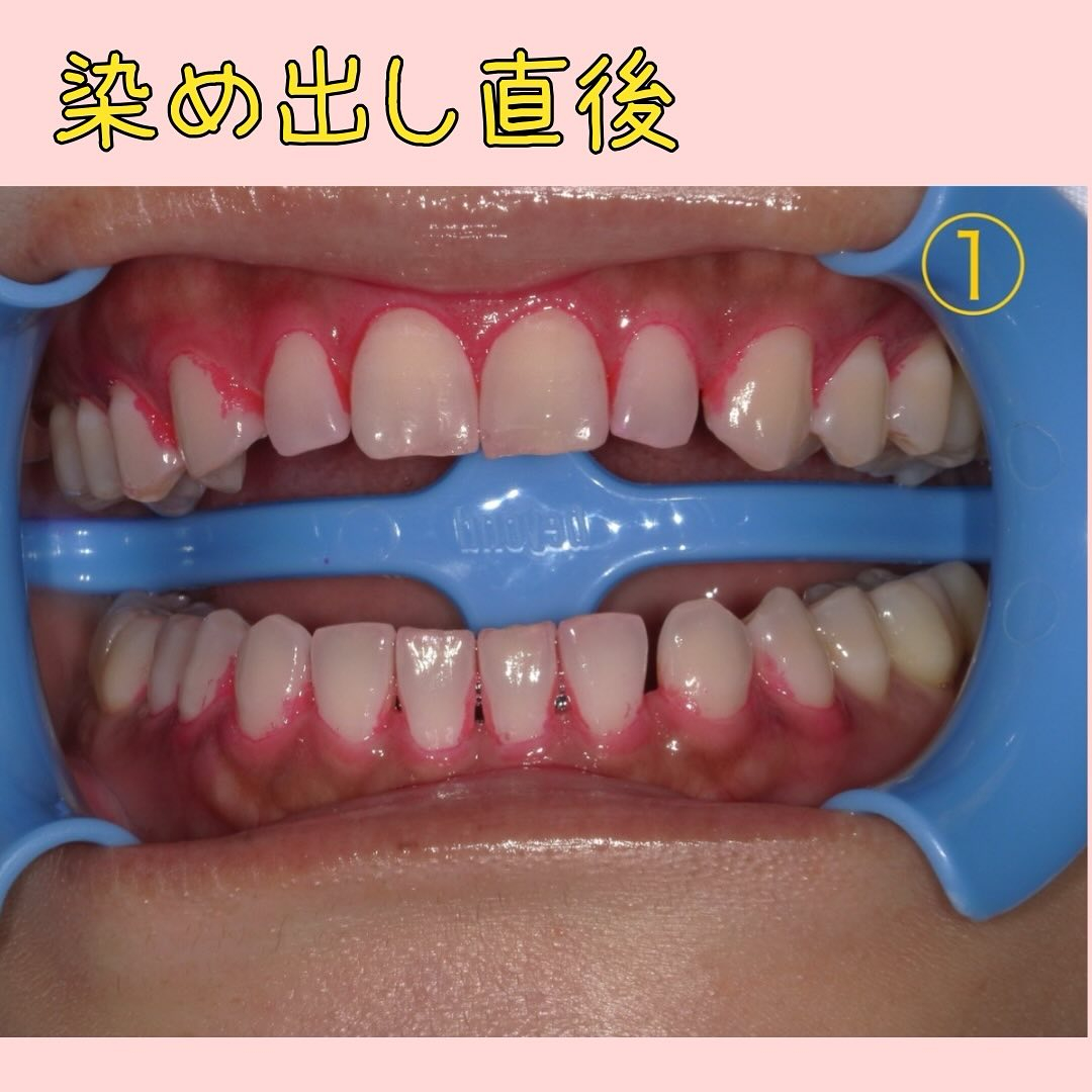 前回の染め出しの続きです🫡