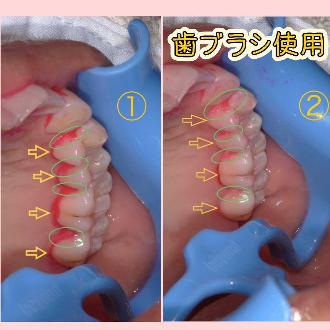 前回の染め出しの続きです🫡