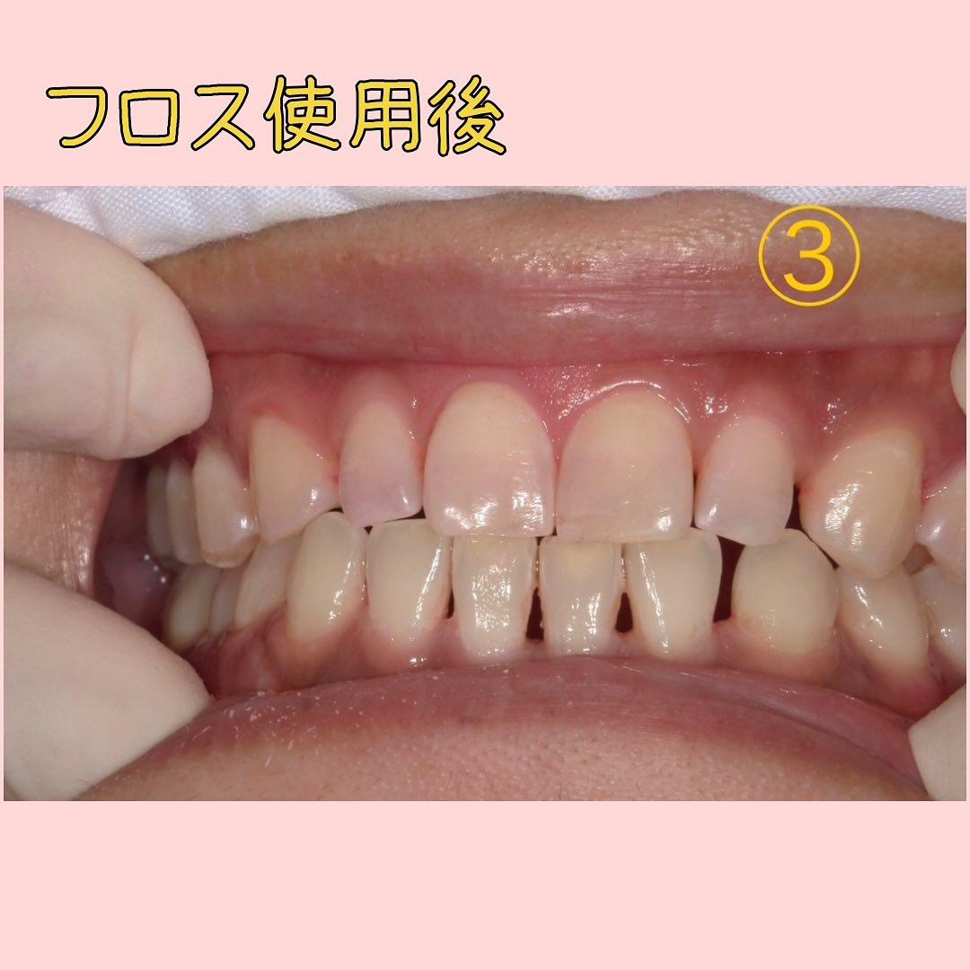 前回の染め出しの続きです🫡