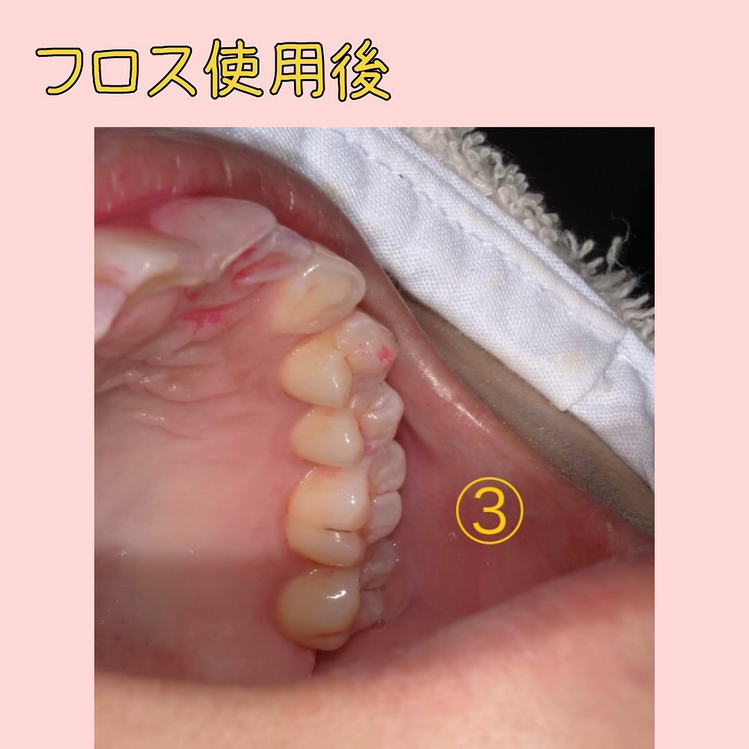 前回の染め出しの続きです🫡