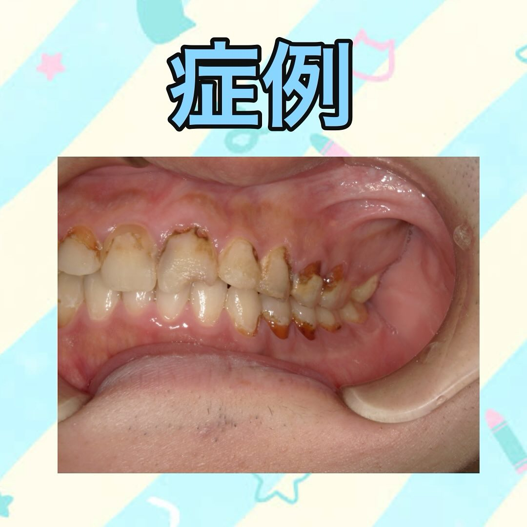 前回、Q&A方式で投稿したスポーツドリンクについての投稿の続...