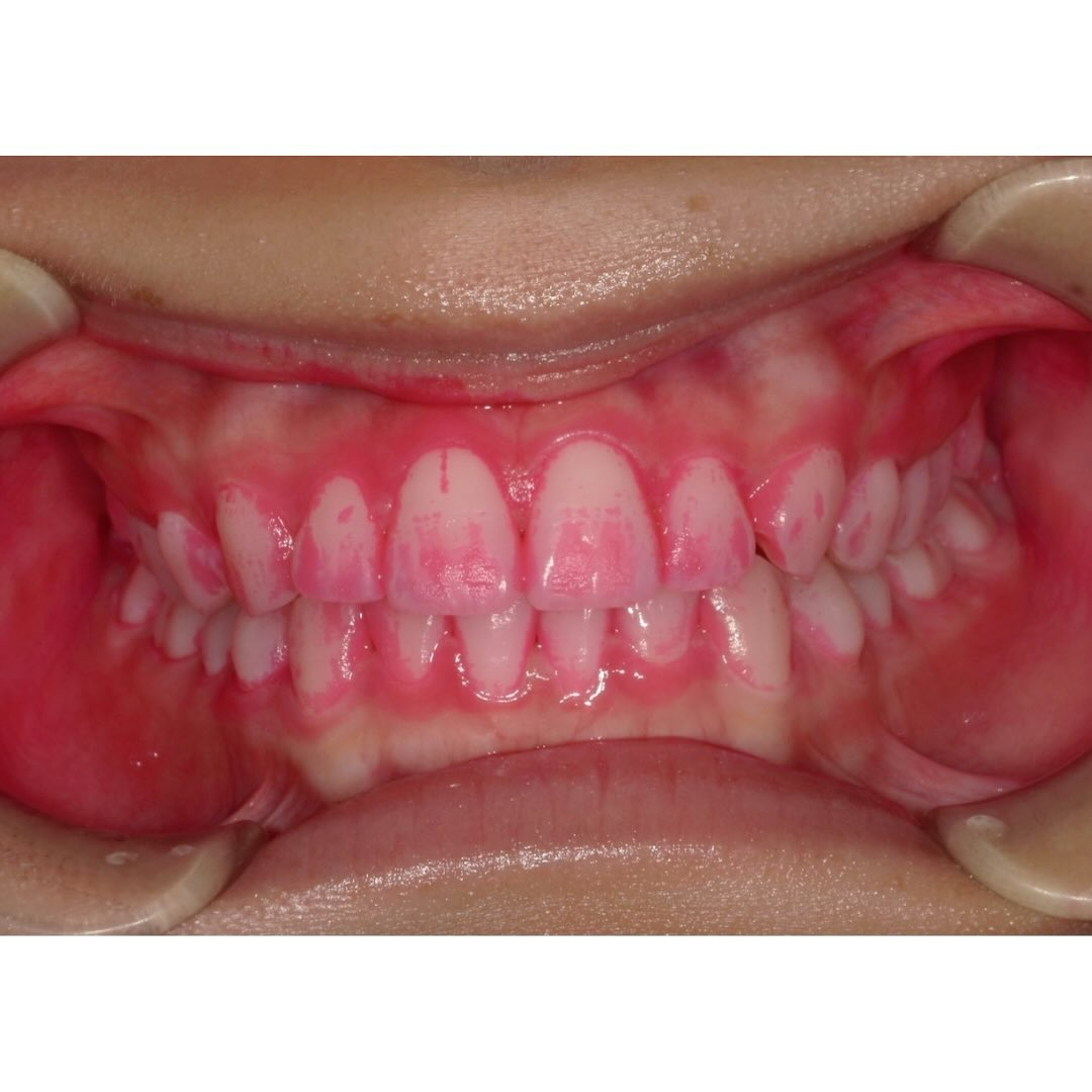 今回は歯科治療の基本、歯磨き指導の相互実習風景をお見せします...