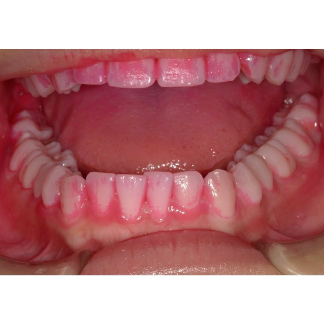 今回は歯科治療の基本、歯磨き指導の相互実習風景をお見せします...