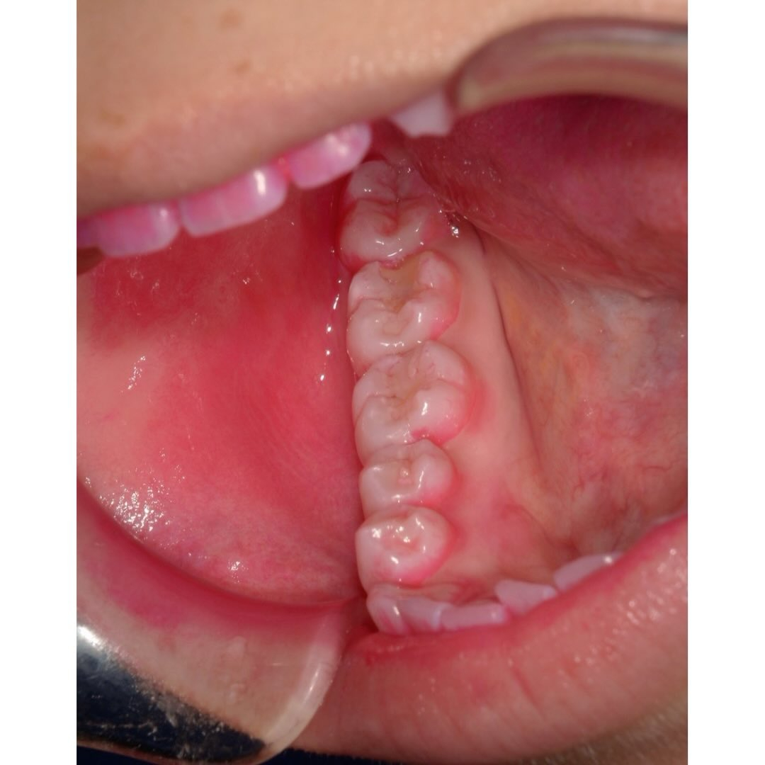 今回は歯科治療の基本、歯磨き指導の相互実習風景をお見せします...