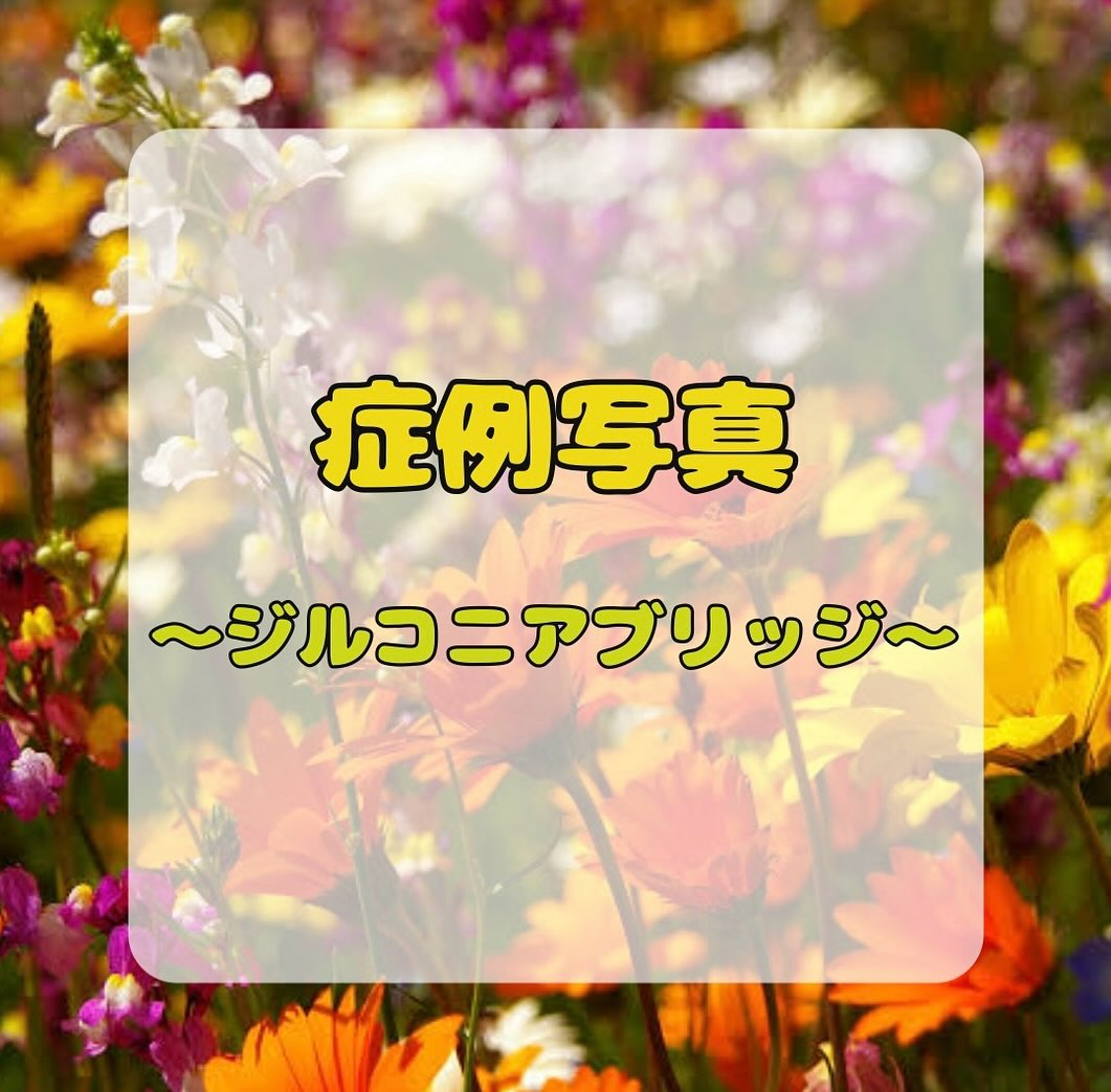 今回紹介する症例は、いつもの保険診療の内容ではなく自由診療の...