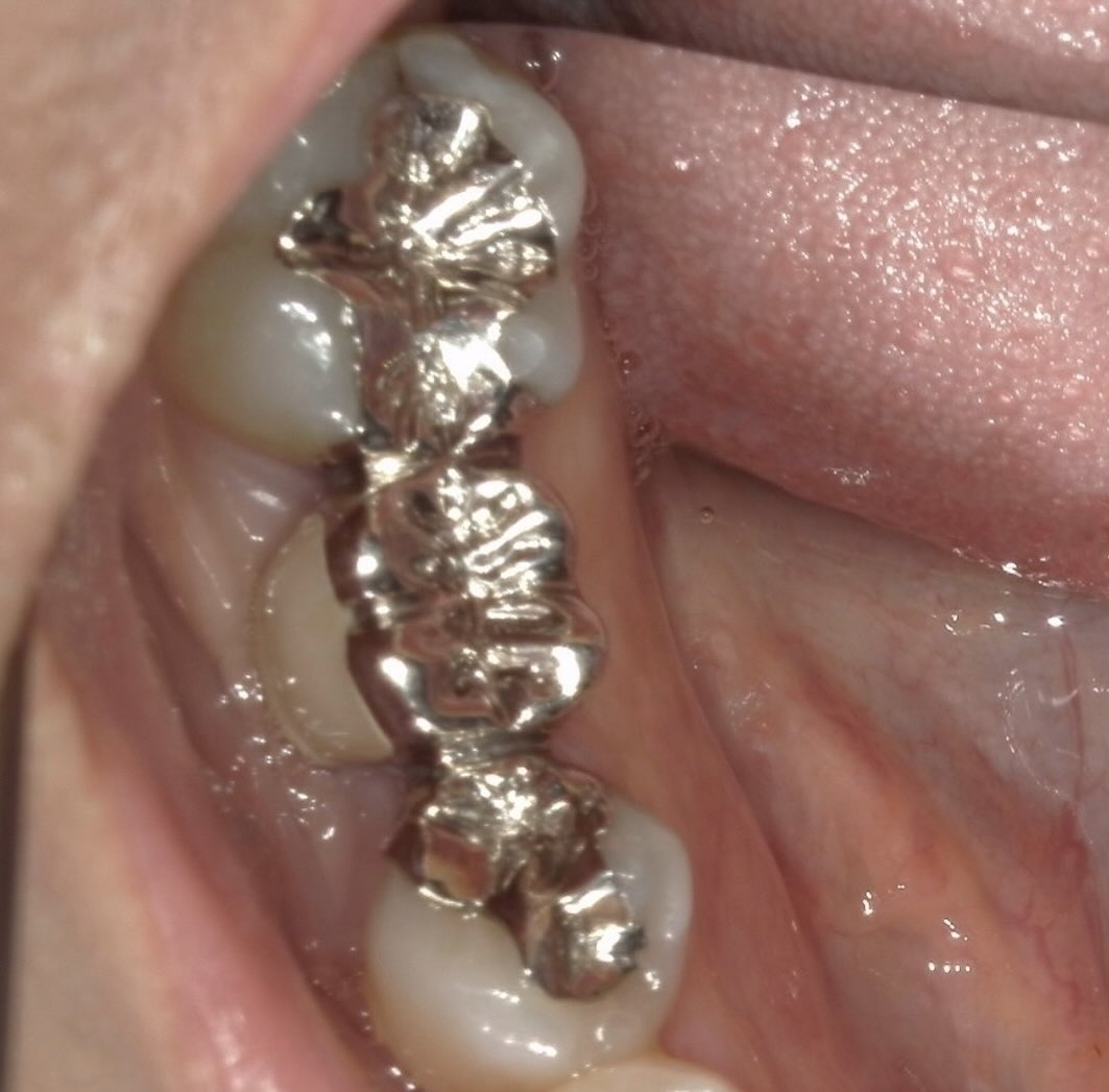 今回紹介する症例は、いつもの保険診療の内容ではなく自由診療の...