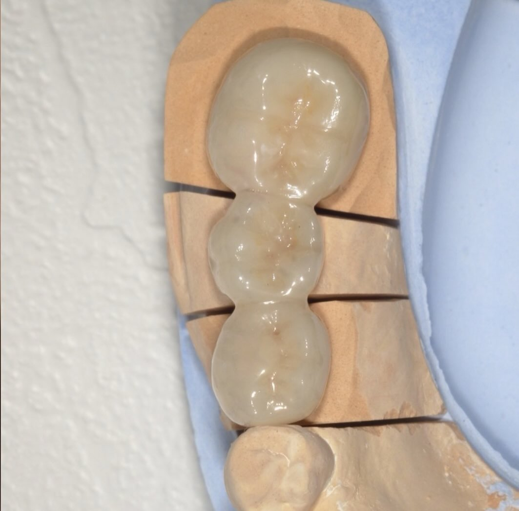 今回紹介する症例は、いつもの保険診療の内容ではなく自由診療の...