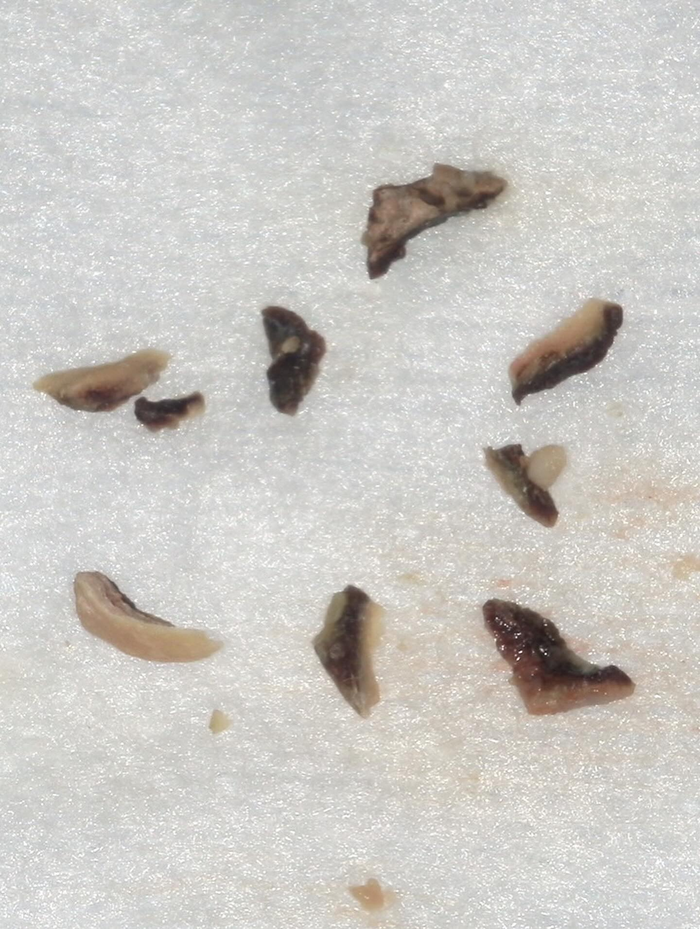 歯石除去前、除去後、除去した歯石の写真です📸☝️