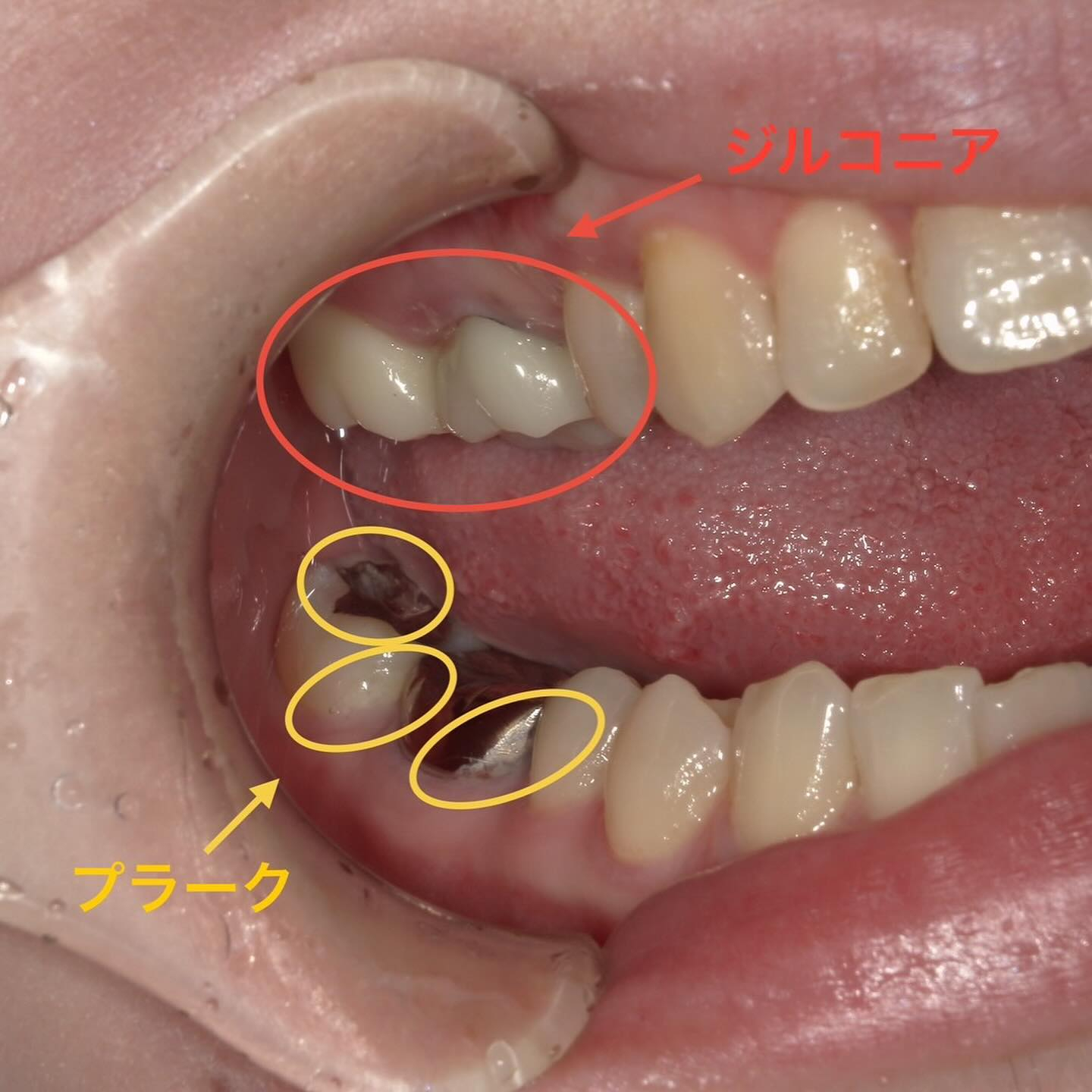 当院は基本的に保険診療を行っております☝️