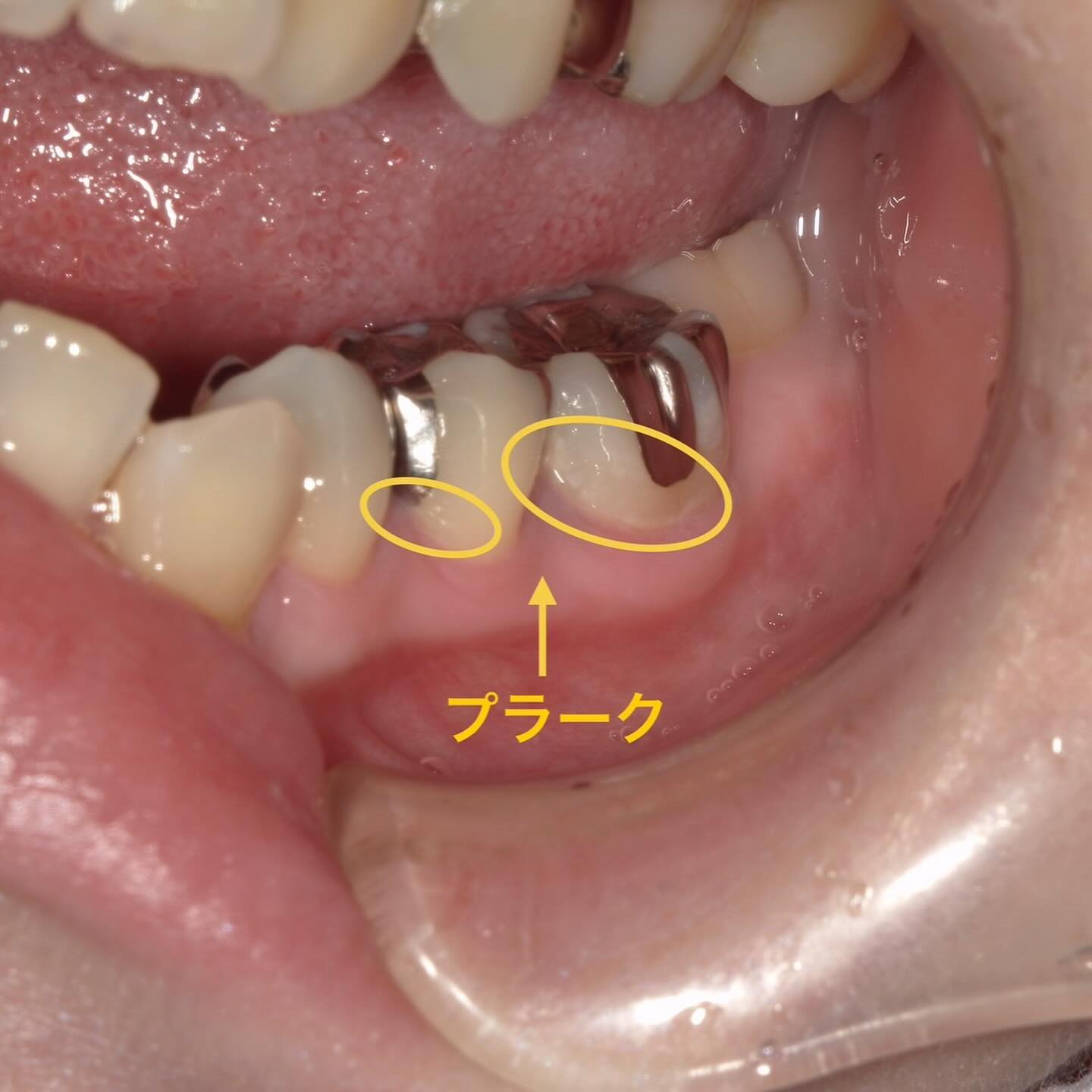 当院は基本的に保険診療を行っております☝️