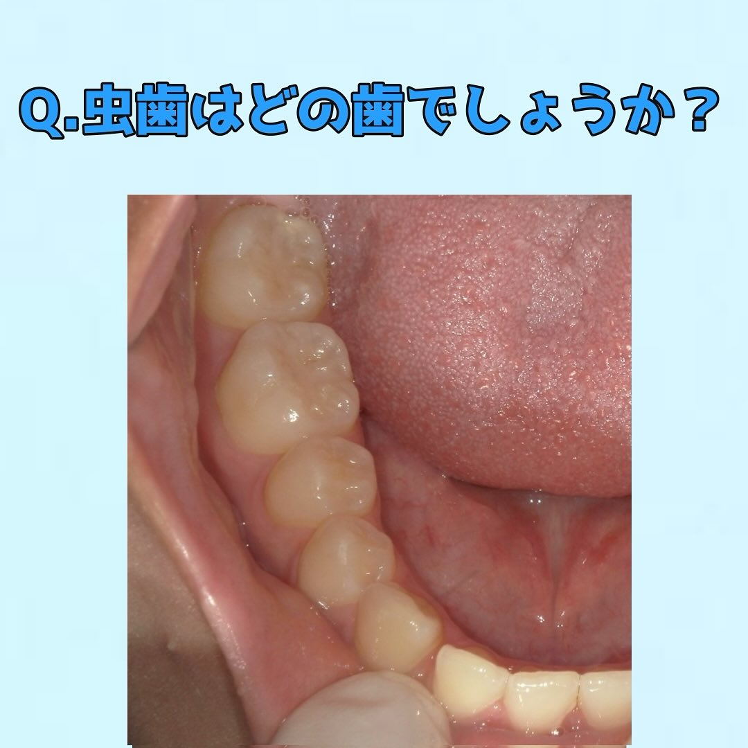 皆さんに質問です👀