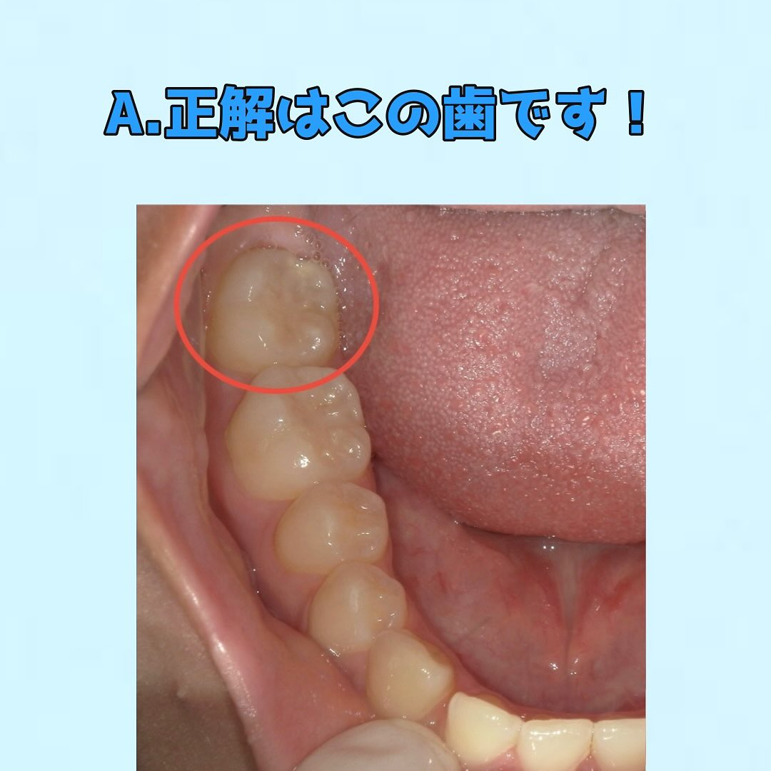 皆さんに質問です👀