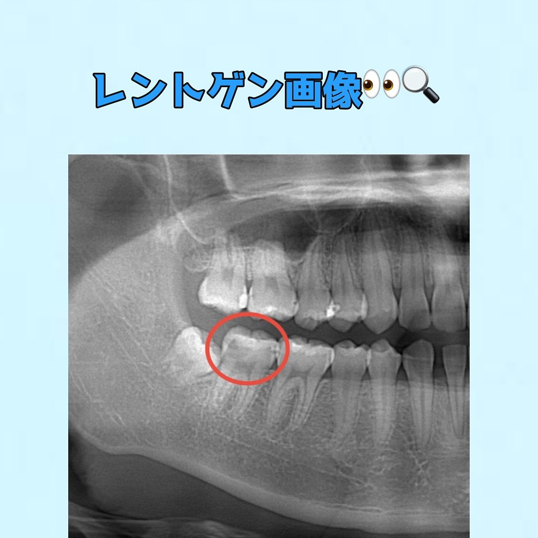 皆さんに質問です👀