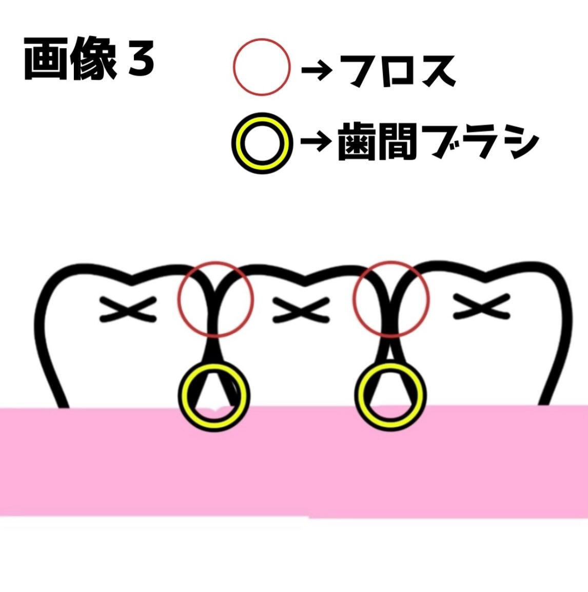 前回に引き続き、今回もフロスのお話です👀