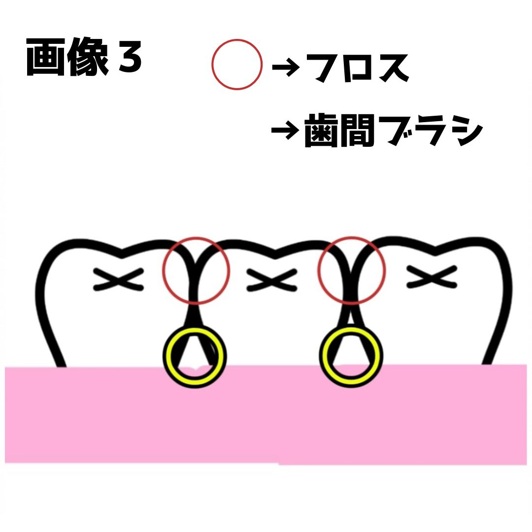 今回はフロス・歯間ブラシの使い方について説明します🙋‍♀️