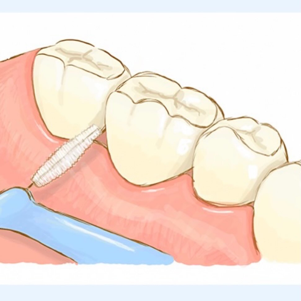 今回はフロス・歯間ブラシの使い方について説明します🙋‍♀️