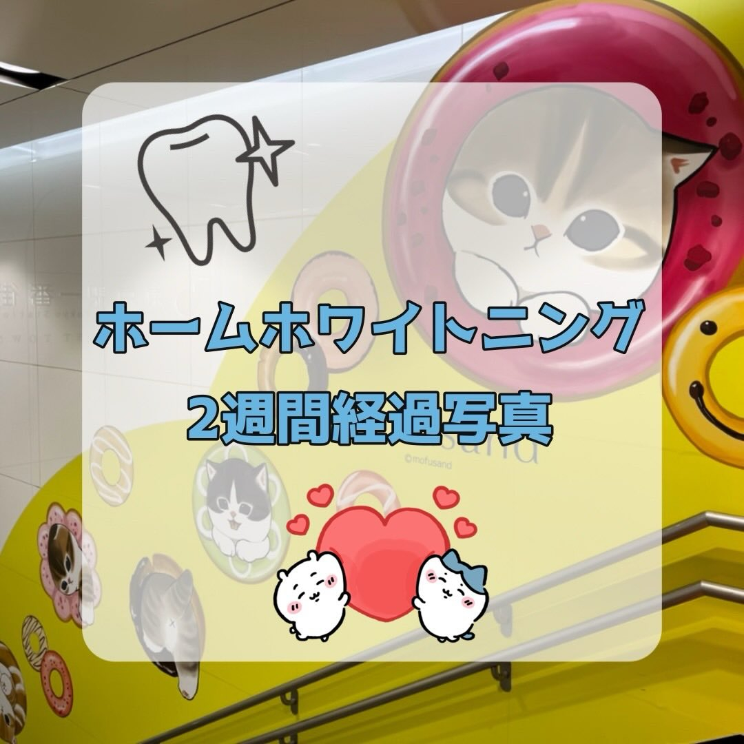 ホームホワイトニング開始後、2週間の経過写真です📸