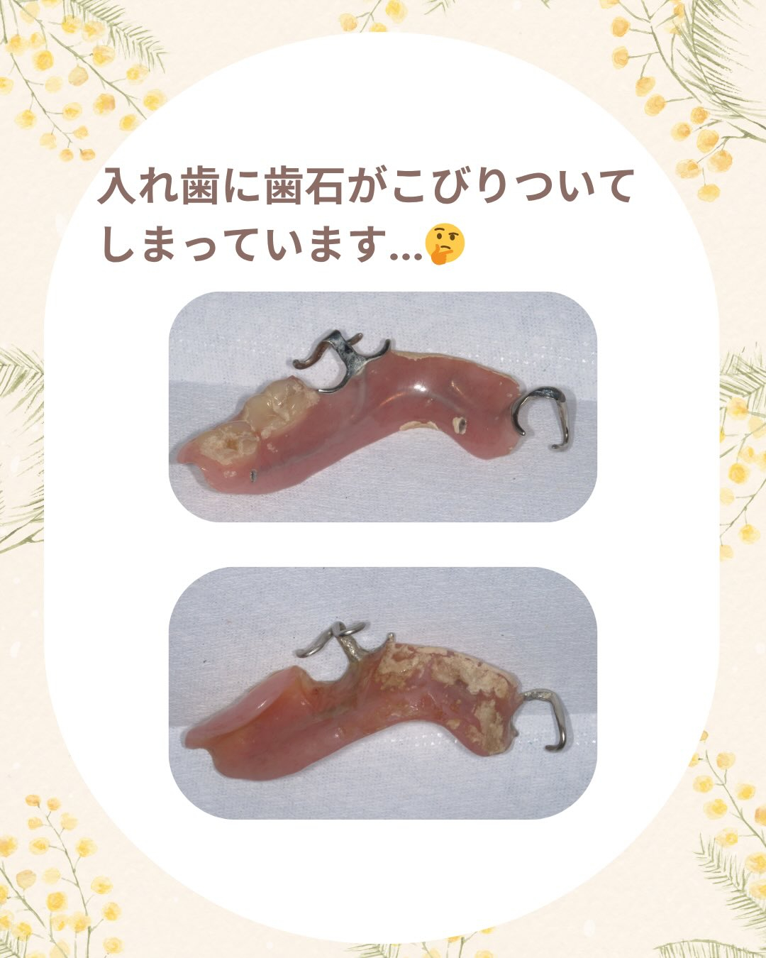 入れ歯(義歯)ケア商品のご案内です🦷