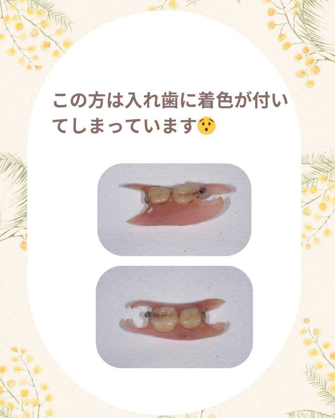 入れ歯(義歯)ケア商品のご案内です🦷