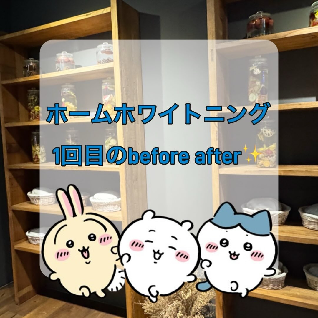 オフィスホワイトニング１回の効果です🧐