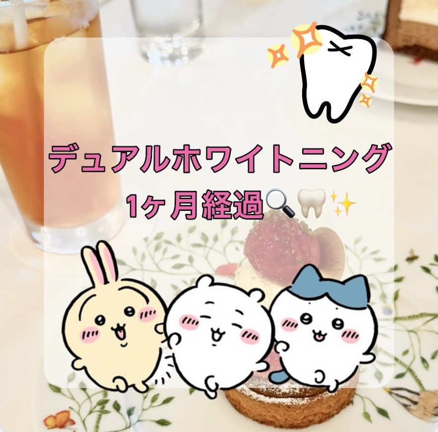 オフィスホワイトニング１回の後、ホームホワイトニングを行って...